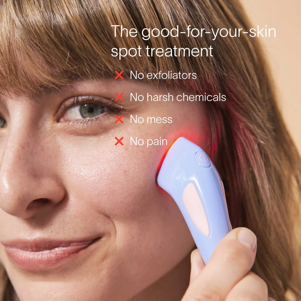 Bye Acne: 3-Minute Pimple Spot Treatment